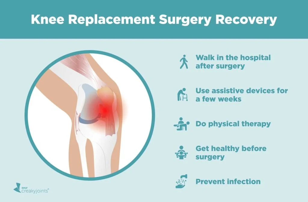 "Informative health booklet front cover displaying 'What I Wish I Knew Before Knee Replacement Surgery' with empathetic design, soft colors, and icons representing mobility and post-op support."